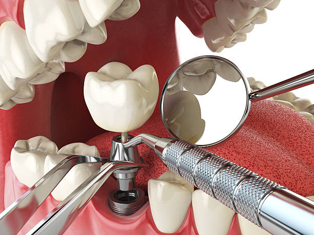 Best Cosmetic Emergency Dentistry in Shelbyville, TN
