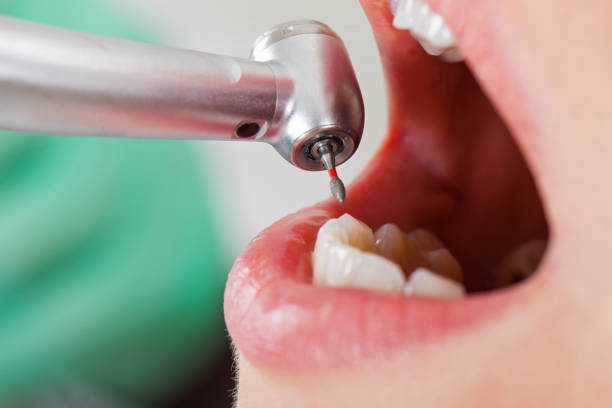 Best Weekend Emergency Dentist in Shelbyville, TN